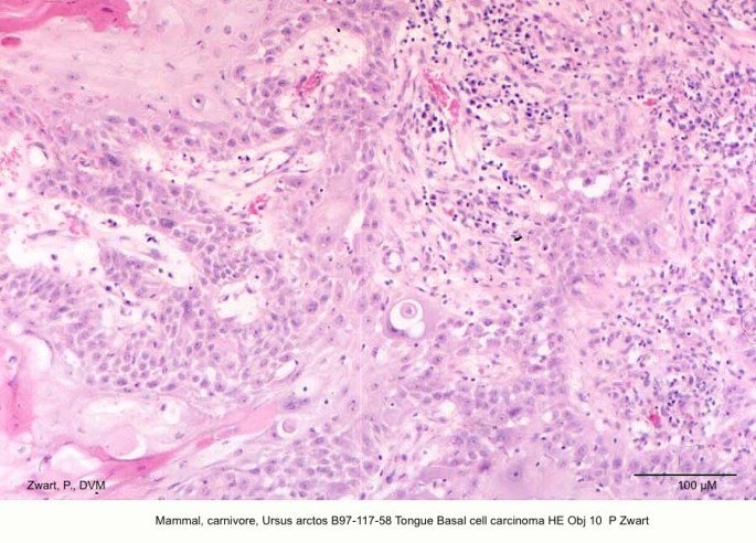 Ursus arctos B97-117-58 Tongue Basal cell carcinoma HE Obj 10 P Zwart copy
