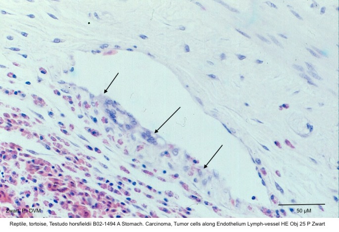 Testudo horsfieldii B02-1494 A Stomach. Carcinoma, Tumor cells along Endothelium Lymph-vessel HE Obj 25 P Zwart kopie