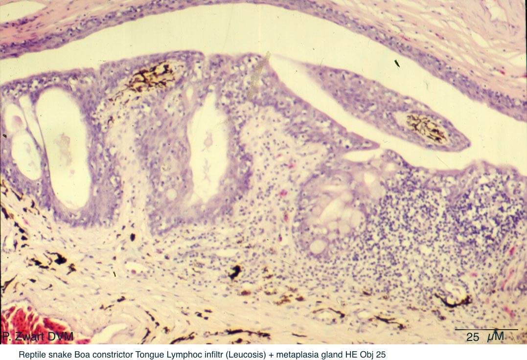 Boa constrictor B06-1029 A Tongue Lymphocytic infiltrate (leucosis) + metaplasia gland HE Obj 25 P Zwart.jpg