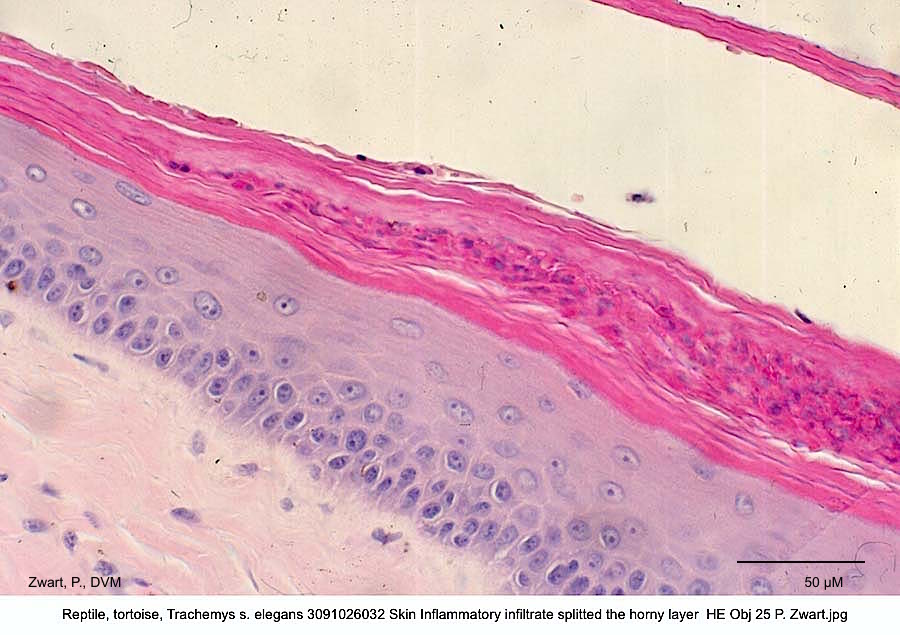 Trachemys s. elegans 3091026032 Skin Inflammatory infiltrate splits the horny layer HE Obj 25 P. Zwart