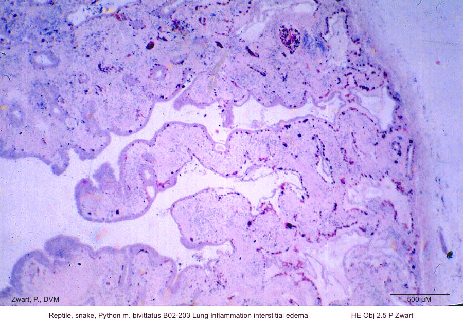 Python m. bivittatus B02-203 Lung Inflammation interstitial oedema along lumen HE Obj 2.5 P Zwart kopie