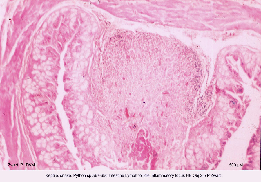 Python sp A67-656 Intestine Lymph follicle inflammatory focus HE Obj 2.5 P Zwart kopie
